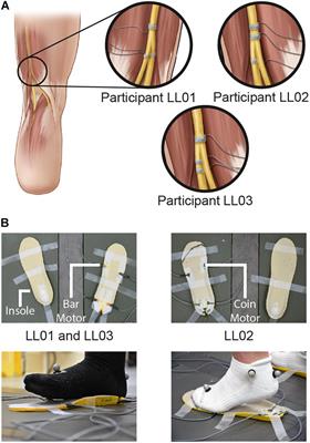 Lower-Limb Amputees Adjust Quiet Stance in Response to Manipulations of Plantar Sensation